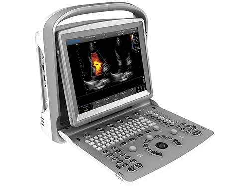 Ultrasound Systems  Ultrasound Systems