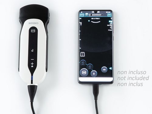 SonoEye P5 Digital Colour Doppler Convex Probe  SonoEye P5 Digital Colour Doppler Convex Probe