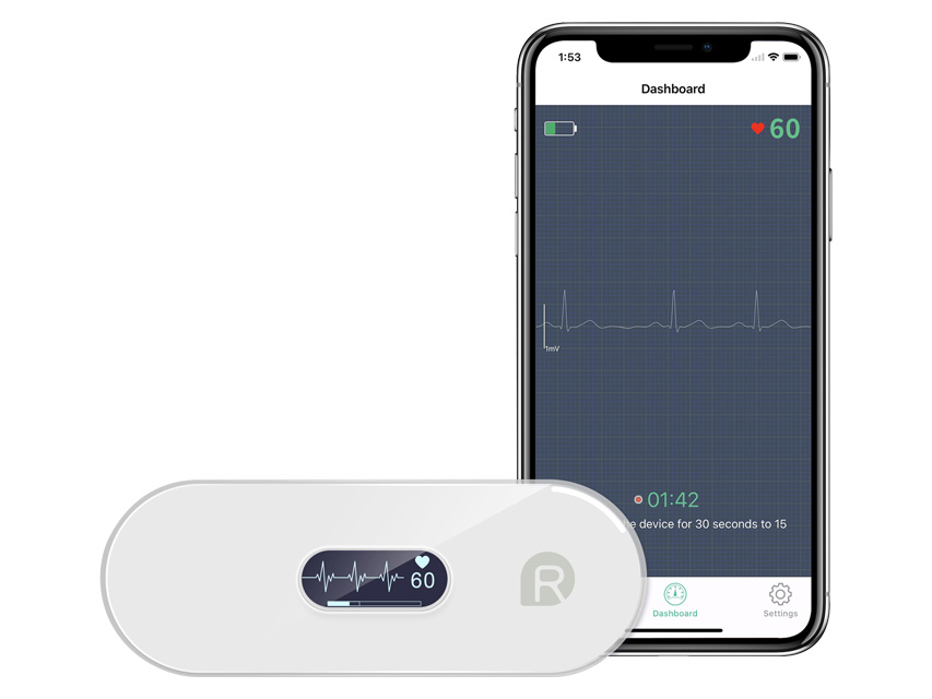 ECG monitor For Instant ECG Analysis