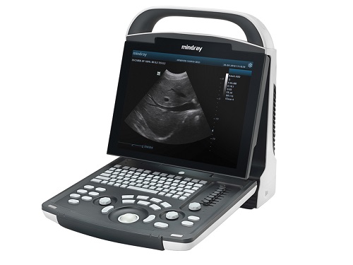 Mindray DP -20 Portable Ultrasound  Mindray DP -20 Portable Ultrasound