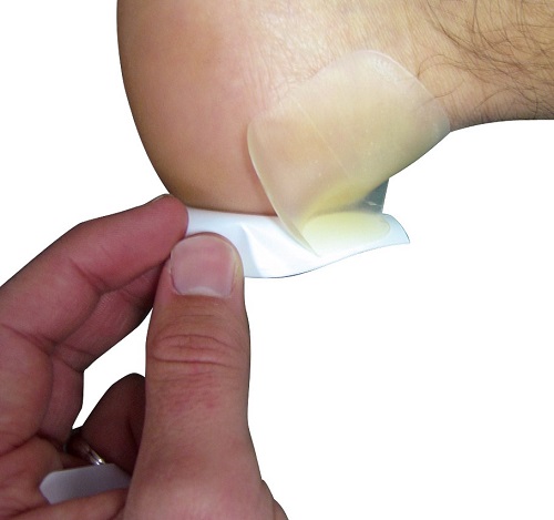 Blister Dressings