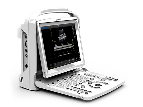 CHISON ECO3EXP Ultrasound with 2 Probe Connectors Without Probe  CHISON ECO3EXP Ultrasound with 2 Probe Connectors Without Probe