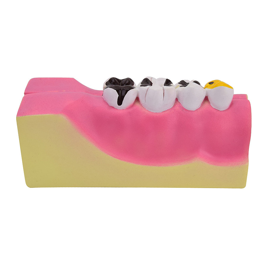 Partial Model Of The Lower Jaw