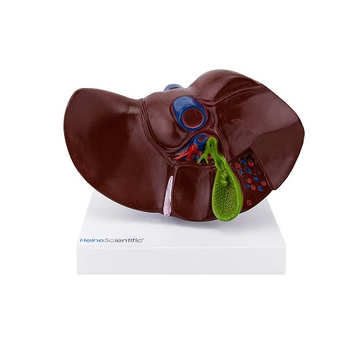 Liver With Gallstones Model