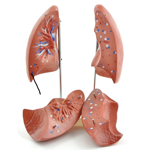 Lung Model