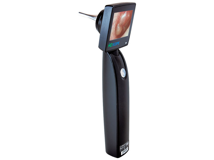 Video Otoscopes  Video Otoscopes